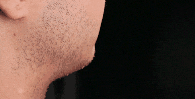 MOTOR -ZERO:A new definition of a razor