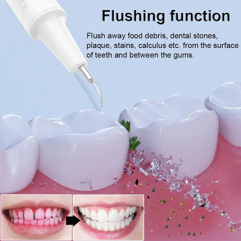 Visual Electric Portable Ultrasonic Tooth Cleaner